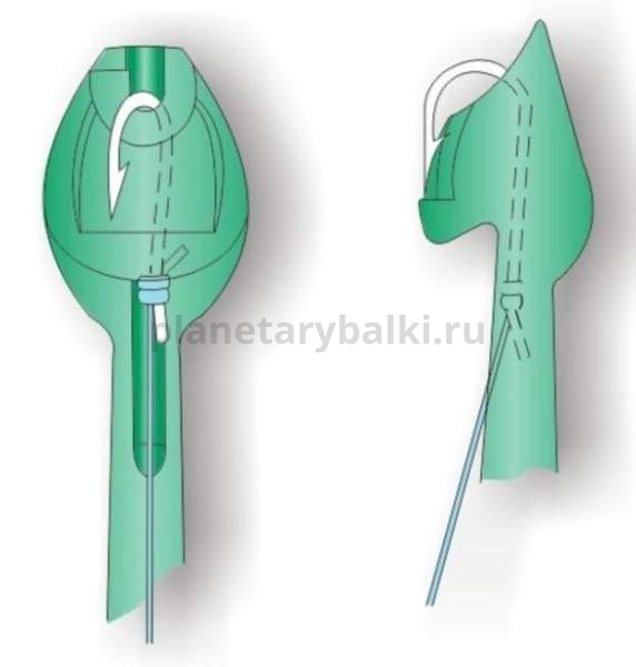 Экстрактор с иглой STONFO ELITE для рыбалки, Экстрактор с иглой STONFO ELITE отзывы, Экстрактор с иглой STONFO ELITE купить, Экстрактор с иглой STONFO ELITE купить в интернет магазине, Экстрактор с иглой STONFO ELITE выбрать, Экстрактор с иглой STONFO ELITE обзор, Экстрактор с иглой STONFO ELITE купить в розничном магазине